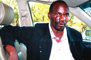Mr Muchengeti Kutsirai with a deep cut under the right eye
