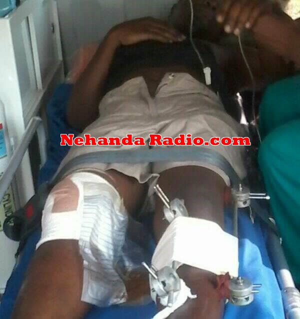 A Zimbabwean truck driver identified as Patrick Murifi (31) sustained serious injuries on both legs after he was allegedly shot at by armed hijackers at the Kasumbalesa border between the Congo and Zambia.