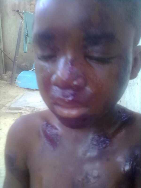 A concerned parent sent this picture to Nehanda Radio via the Citizen Reports on Whatsapp. This was a boy who had ten the bilharzia medication