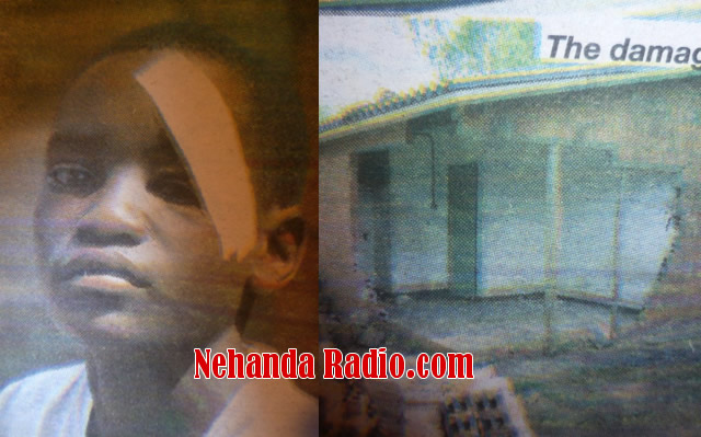 The injured school boy Kudakwashe Kazhazhe and the house that was damaged