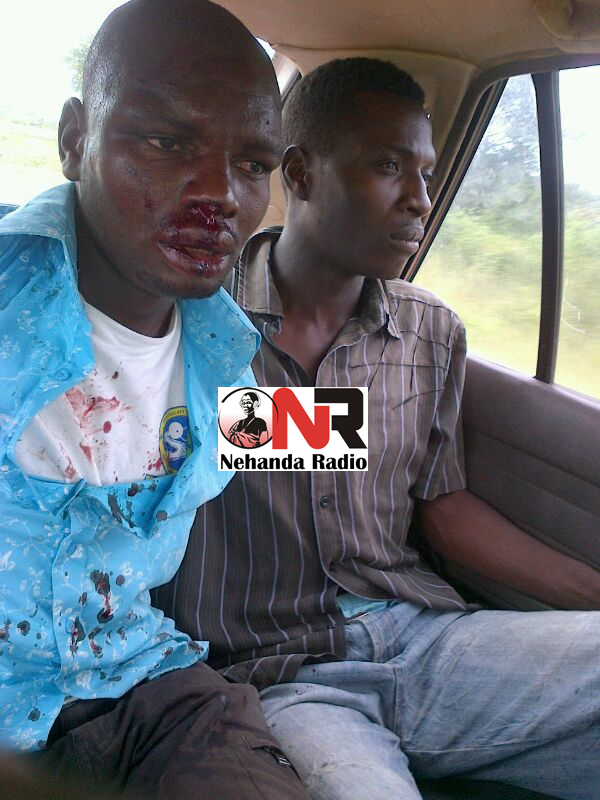 Motorbike thief beaten up3