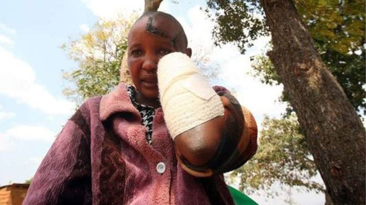 Jackline Mwende reportedly accused her husband of being drunk when he attacked her