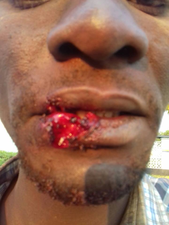 Axe-wielding Zanu PF youths attack ZimPF officials
