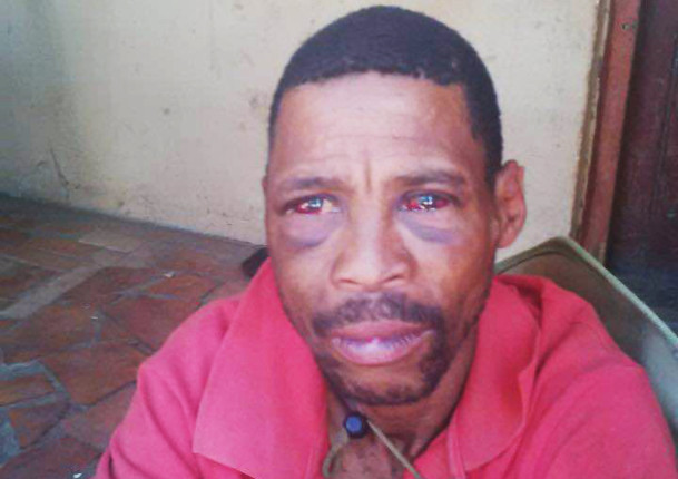 Lutzville farmworker Johannes Baadjies was assaulted and then allegedly offered R400 to drop the case.