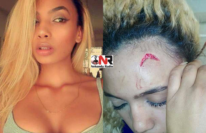 Gabriella Engels claimed on Monday that she was assaulted by Grace Mugabe following an altercation at a Sandton hotel at about 9pm on Sunday night.