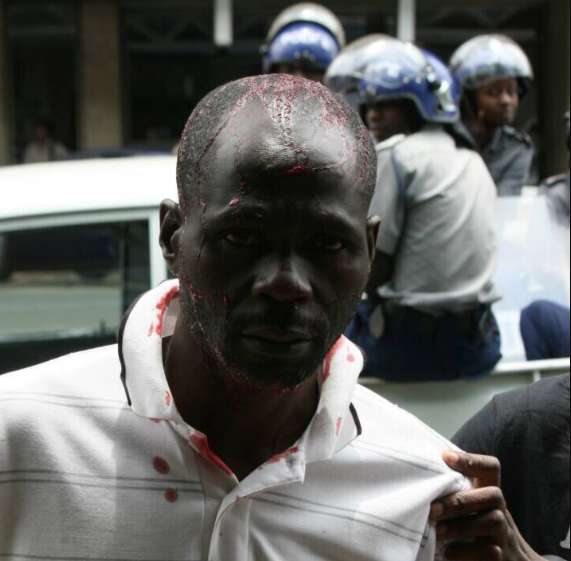 The police, who were indiscriminately firing pellets at civilians, seriously injured Daily News senior reporter Mugove Tafirenyika and photo-journalist Brighton Goko who were on duty.