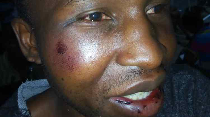 Doubles wekwaMarange after being attacked