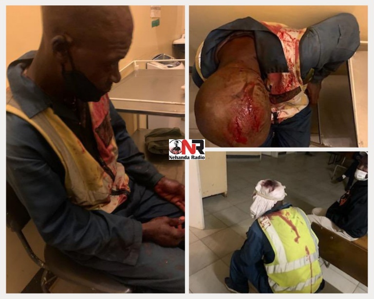 The guard whose head, nose and hands are bandaged narrated how he was attacked while guarding Tendai Biti's home.
