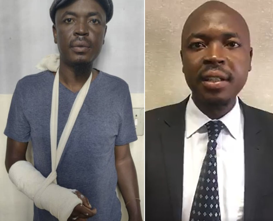 Harare based lawyer Kudzayi Kadzere was beaten by members of the Zimbabwe Republic Police (ZRP), leaving him with a fractured hand that required surgery.
