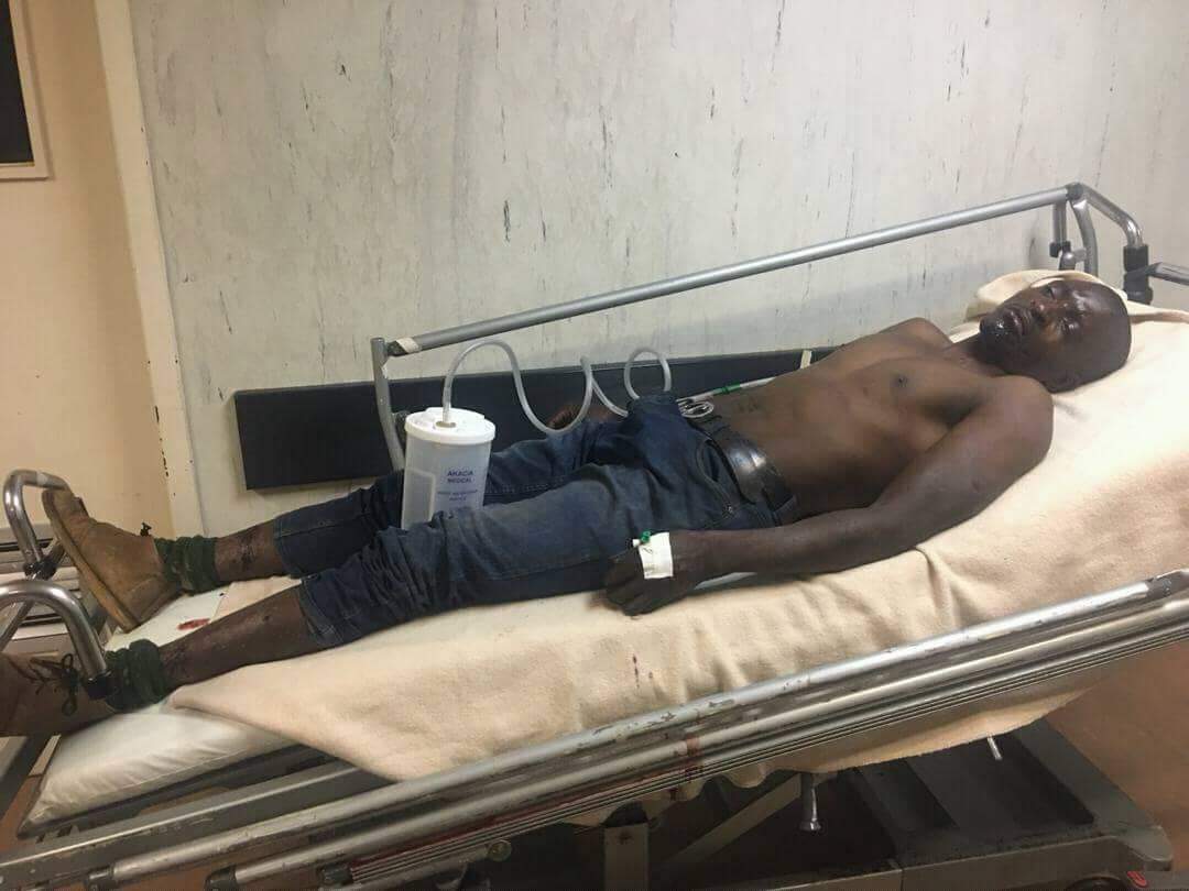 Former opposition Citizens Coalition for Change (CCC) Member of Parliament (MP) for Mabvuku-Tafara, James Chidhakwa was reportedly abducted and tortured by unknown assailants (Picture via Twitter - @Silvanosbhandit)