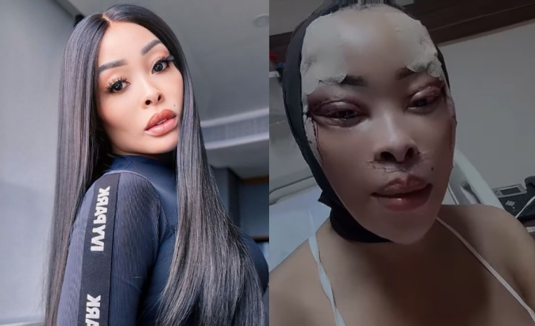 Reality TV star Khanyi Mbau 'buys' new face, criticised for addiction to  surgery – Nehanda Radio