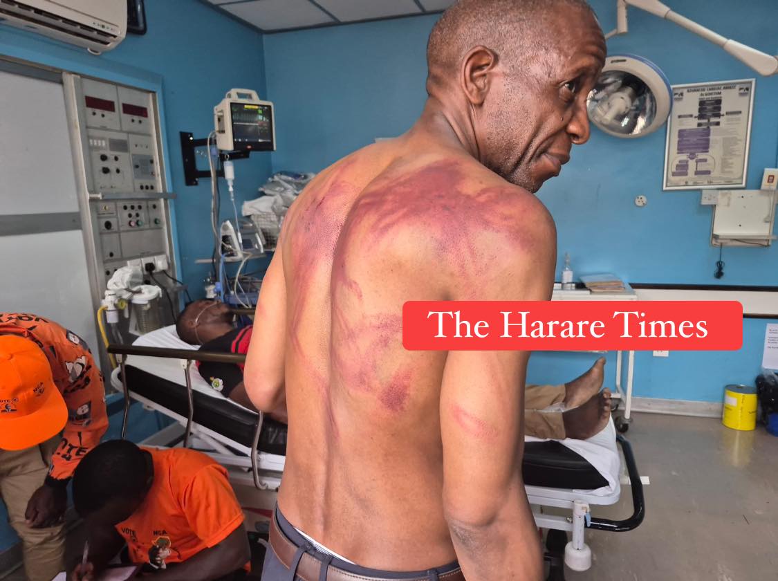 Prominent lawyer Madhuku beaten by men in balaclavas ‘as police watch’